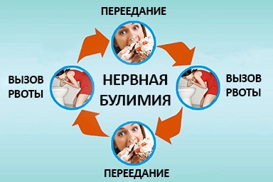 Лечение булимии в Мценске